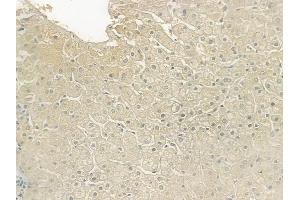ABIN6258754 and ABIN6274953 at 1/100 staining human normal liver tissue by IHC-P. (CHST13 抗体  (Internal Region))