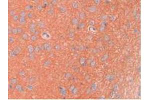 IHC-P analysis of Rat Brain Tissue, with DAB staining. (SPTAN1 抗体  (AA 2071-2269))