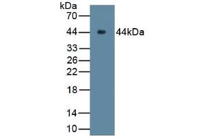 Western blot analysis of recombinant Rabbit C9. (C9 抗体  (AA 139-519))