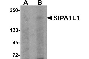 Western Blotting (WB) image for anti-Signal-Induced Proliferation-Associated 1 Like 1 (SIPA1L1) (N-Term) antibody (ABIN1031564) (SIPA1L1 抗体  (N-Term))