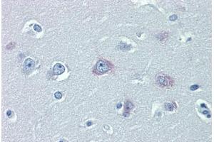 Immunohistochemistry (Formalin-fixed Paraffin-embedded Sections) (IHC (fp)) image for anti-Transient Receptor Potential Cation Channel, Subfamily M, Member 2 (TRPM2) (AA 431-480) antibody (ABIN490062)