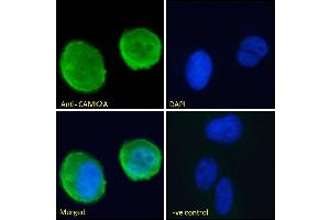(ABIN570984) Immunofluorescence analysis of paraformaldehyde fixed U2OS cells, permeabilized with 0. (CaMKII alpha/beta (Internal Region) 抗体)