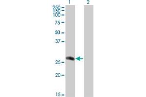 Western Blot analysis of CDC42EP2 expression in transfected 293T cell line by CDC42EP2 monoclonal antibody (M01), clone 2H7. (CDC42EP2 抗体  (AA 102-210))