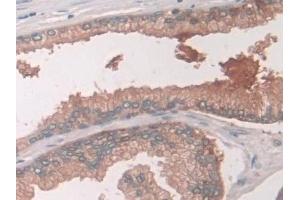 Immunohistochemistry (IHC) image for anti-USP6 N-terminal Like (USP6NL) (AA 1-292) antibody (ABIN7430093)
