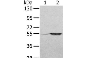 Western Blot analysis of A375 cell and Human fetal muscle tissue using TRIM35 Polyclonal Antibody at dilution of 1:550 (TRIM35 抗体)