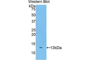 Western Blotting (WB) image for anti-ADAM Metallopeptidase with Thrombospondin Type 1 Motif, 7 (ADAMTS7) (AA 1589-1686) antibody (ABIN3205721) (ADAMTS7 抗体  (AA 1589-1686))