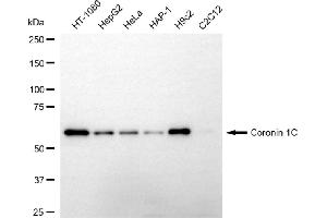 Western blotting analysis using coronin 1C antibody (ABIN7798157).
