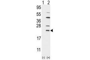 Western blot analysis of UBE2C (arrow) using rabbit polyclonal UBE2C Antibody (UBE2C 抗体  (N-Term))