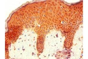 Immunohistochemistry of paraffin-embedded human skin tissue using ABIN7155744 at dilution of 1:100 (HOXB7 抗体  (AA 1-120))