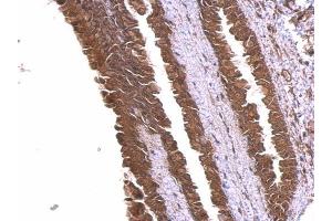 IHC-P Image alpha Adducin antibody detects alpha Adducin protein at membrane and cytosol on mouse esophagus by immunohistochemical analysis. (alpha Adducin 抗体)