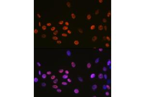 Immunofluorescence analysis of C6 cells using DDX5 Rabbit mAb (ABIN7266698) at dilution of 1:100 (40x lens). (DDX5 抗体)