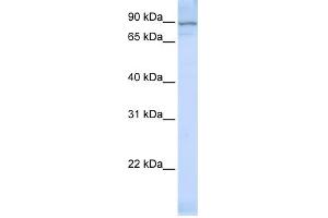 WB Suggested Anti-ZNF598 Antibody Titration:  0. (ZNF598 抗体  (Middle Region))