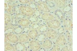Immunohistochemistry of paraffin-embedded human kidney tissue using ABIN7145332 at dilution of 1:100 (BNIP3L/NIX 抗体  (AA 1-187))