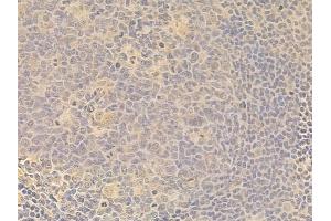 SGK1 Antibody at 1/100 staining human normal tonsil tissue by IHC-P. (SGK1 抗体)
