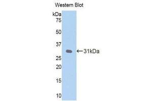Western Blotting (WB) image for anti-C-Reactive Protein (CRP) (AA 20-225) antibody (ABIN1077877) (CRP 抗体  (AA 20-225))