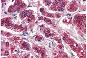 Human Adrenal: Formalin-Fixed, Paraffin-Embedded (FFPE) (APOE 抗体)