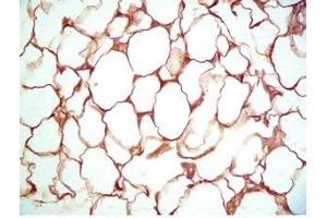 Rat visceral white fat tissue was stained by Rabbit Anti-Vaspin (386-414) (Human) Serum (SERPINA12 抗体  (AA 386-414))