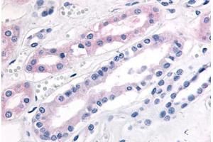 Human Kidney (formalin-fixed, paraffin-embedded) stained with PDE2A antibody ABIN213546 at 20 ug/ml followed by biotinylated goat anti-rabbit IgG secondary antibody ABIN481713, alkaline phosphatase-streptavidin and chromogen. (PDE2A 抗体  (N-Term))