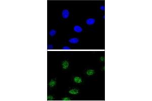 Immunofluorescence (IF) image for anti-Estrogen-Related Receptor alpha (ESRRA) (AA 131-159) antibody (ABIN652575)