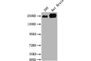 Western Blot Positive WB detected in: 293 whole cell lysate, Rat Brain tissue All lanes: MYH10 antibody at 1:2000 Secondary Goat polyclonal to rabbit IgG at 1/50000 dilution Predicted band size: 229, 231, 232, 233 kDa Observed band size: 250 kDa (MYH1 抗体  (AA 1439-1544))