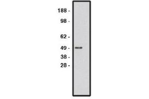Image no. 1 for anti-Roundabout, Axon Guidance Receptor, Homolog 1 (ROBO1) antibody (ABIN265227) (ROBO1 抗体)
