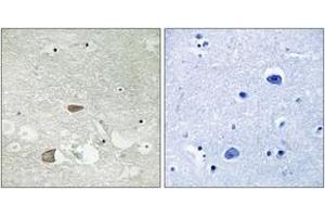 Immunohistochemistry analysis of paraffin-embedded human brain tissue, using CELSR2 Antibody. (CELSR2 抗体  (AA 2781-2830))