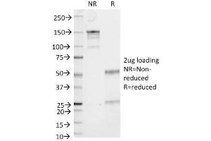SDS-PAGE Analysis Purified CD53 Mouse Monoclonal Antibody (161-2). (CD53 抗体)