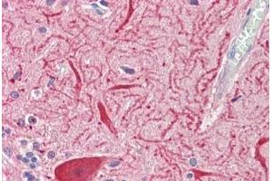Human Brain, Cerebellum: Formalin-Fixed, Paraffin-Embedded (FFPE) (SLC2A13 抗体  (AA 268-297))