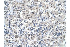 Immunohistochemistry (IHC) image for anti-Cerebellar Degeneration-Related Protein 2, 62kDa (CDR2) (N-Term) antibody (ABIN311402) (CDR2 抗体  (N-Term))