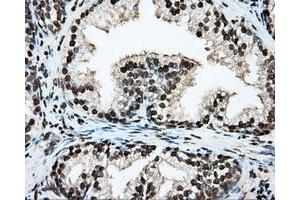 Immunohistochemical staining of paraffin-embedded lung tissue using anti-ARNTL mouse monoclonal antibody. (ARNTL 抗体)