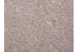 Immunohistochemistry (IHC) image for anti-Arginase, Type II (ARG2) (AA 23-354) antibody (ABIN7435613)