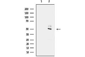anti-Sorting Nexin 17 (SNX17) (N-Term) antibody