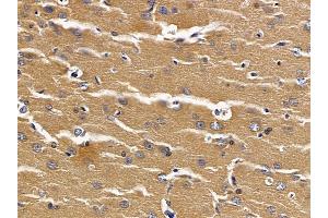 NAT14 Antibody at 1/100 staining rat brain tissue by IHC-P. (NAT14 抗体  (C-Term))