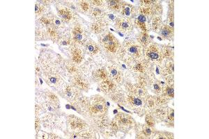 Immunohistochemistry of paraffin-embedded human liver injury using DARS antibody at dilution of 1:100 (x40 lens). (DARS 抗体)