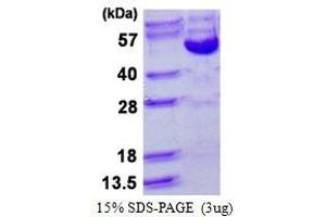 Image no. 1 for Cyclin B2 (CCNB2) (AA 1-398) protein (His tag) (ABIN1098633)
