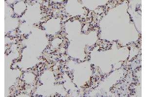 ABIN6276948 at 1/100 staining Rat lung tissue by IHC-P. (PAD4 抗体  (N-Term))