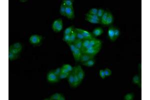 Immunofluorescence staining of HepG2 cells with ABIN7155981 at 1:100, counter-stained with DAPI. (HAO1 抗体  (AA 161-273))