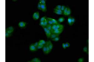Immunofluorescence staining of HepG2 cells with ABIN7155981 at 1:100, counter-stained with DAPI. (HAO1 抗体  (AA 161-273))