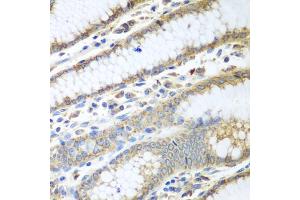 Immunohistochemistry of paraffin-embedded human stomach using PDIA3 antibody (ABIN5970443) at dilution of 1/100 (40x lens). (PDIA3 抗体)