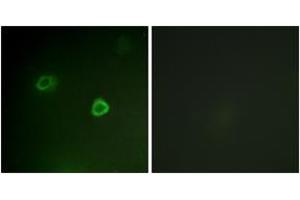 Immunofluorescence (IF) image for anti-Ribosomal Protein S6 Kinase, 90kDa, Polypeptide 3 (RPS6KA3) (AA 539-588), (pThr573) antibody (ABIN1531364)