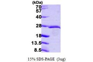 Eukaryotic Translation Initiation Factor 3 Subunit K (EIF3K) (AA 1-218) protein (His tag)