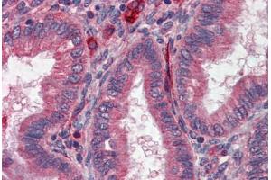 Human Uterus: Formalin-Fixed, Paraffin-Embedded (FFPE) (Acetylcholinesterase 抗体)