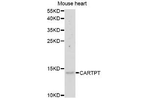 Western blot analysis of extracts of mouse heart, using CARTPT antibody (ABIN5975373) at 1/1000 dilution. (CARTPT 抗体)