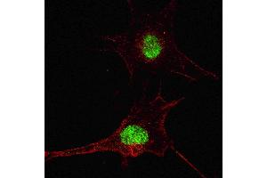 Fluorescent confocal image of SY5Y cells stained with SOX2  antibody. (SOX2 抗体  (AA 251-284))