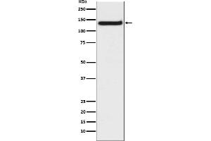 Western blot analysis of TLR9 expression in Raji cell lysate.