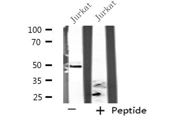 Septin 6 抗体  (Internal Region)