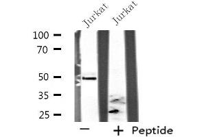 Western blot analysis of extracts from Jurkat cells, using SEPT6 antibody. (Septin 6 抗体  (Internal Region))