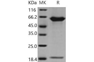 Western Blotting (WB) image for Proprotein Convertase Subtilisin/kexin Type 9 (PCSK9) (Active) protein (His tag) (ABIN7321244) (PCSK9 Protein (His tag))