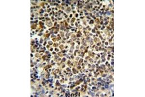 Immunohistochemistry (IHC) image for anti-Killer Cell Immunoglobulin-Like Receptor, Two Domains, Long Cytoplasmic Tail, 5B (KIR2DL5B) antibody (ABIN3003959) (KIR2DL5B 抗体)