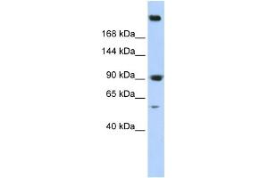 WB Suggested Anti-SPTAN1 Antibody Titration: 0. (SPTAN1 抗体  (N-Term))